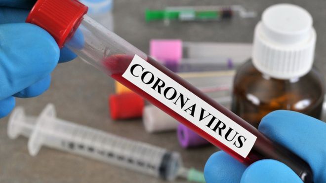 A new coronavirus-related death among diaspora Palestinians raises total to 201
