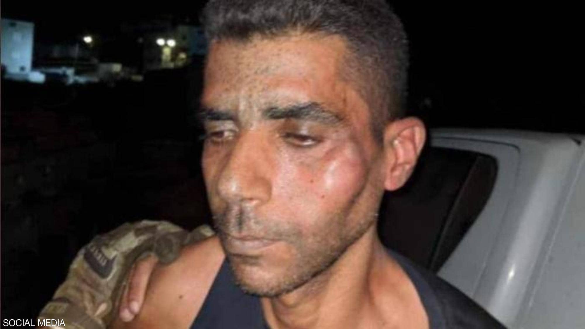 Freedom fighter Zakaria Zubeidi hospitalized due to acute beating by Israeli police