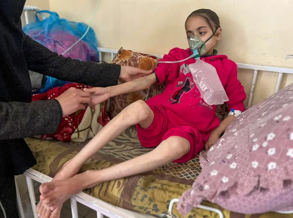 Gaza: 67 children dead from malnutrition so far, over 650,000 at immediate risk